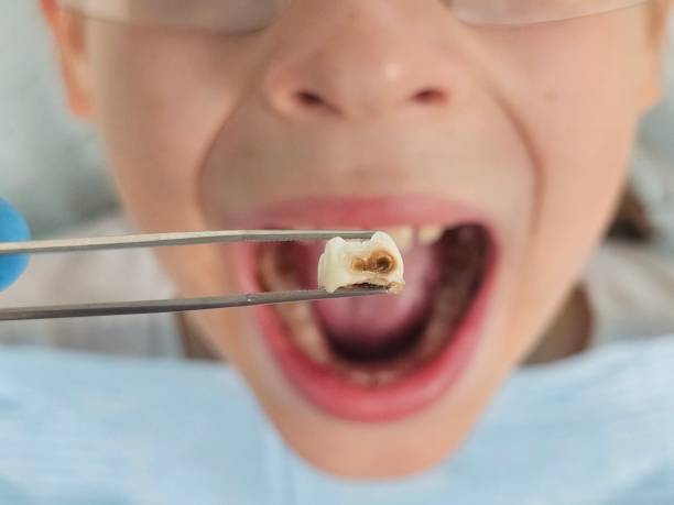 Best Emergency Care for Gum Disease in Emmon, AK